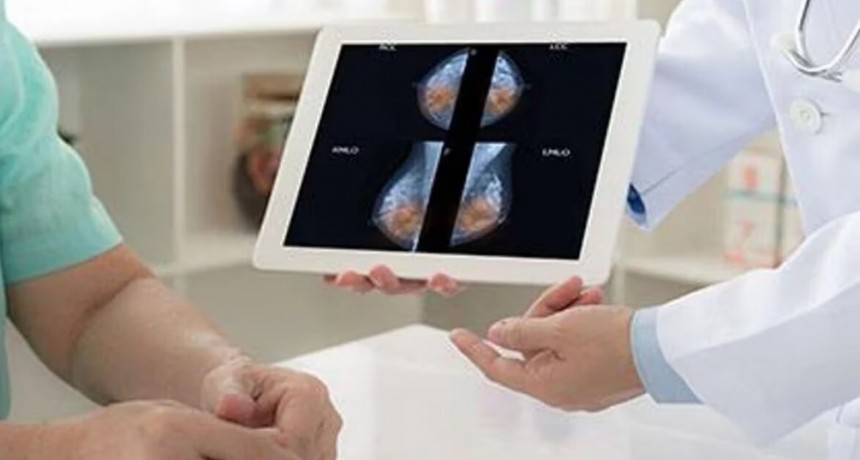 Científicos descubren una nueva forma de combatir el cáncer de mama con de estrógenos