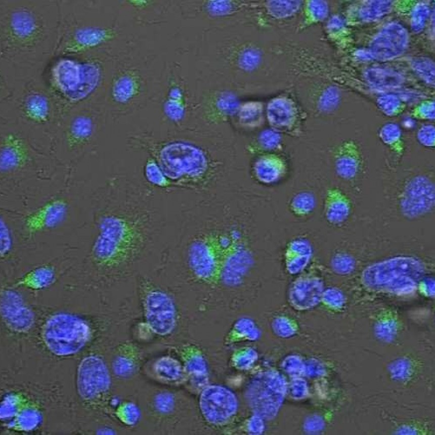 Posible nuevo fármaco para reducir sustancialmente la metástasis en el cáncer de mama