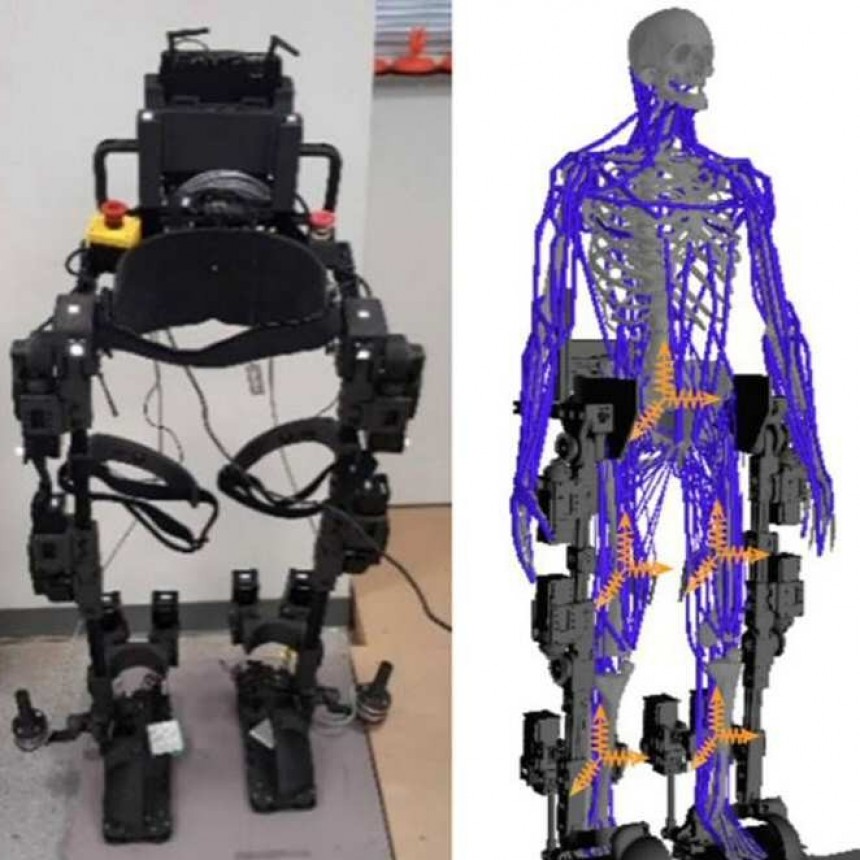 Prótesis con inteligencia artificial