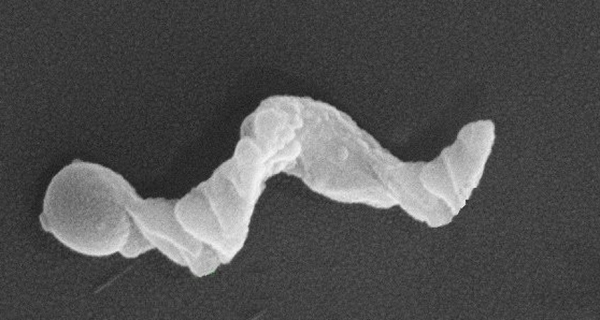 Nanorrobots: La revolución en la entrega de medicamentos