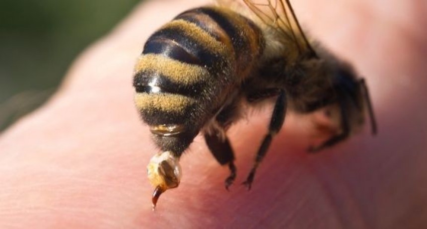 LO PICO UNA ABEJA Y MURIO