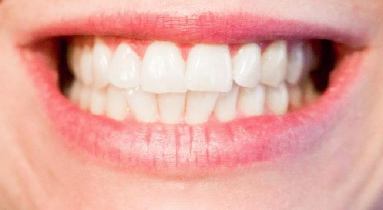 Una startup japonesa desarrolla un fármaco pionero para hacer crecer nuevos dientes en humanos